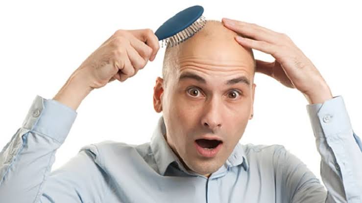 আজ টাক হওয়ার দিন